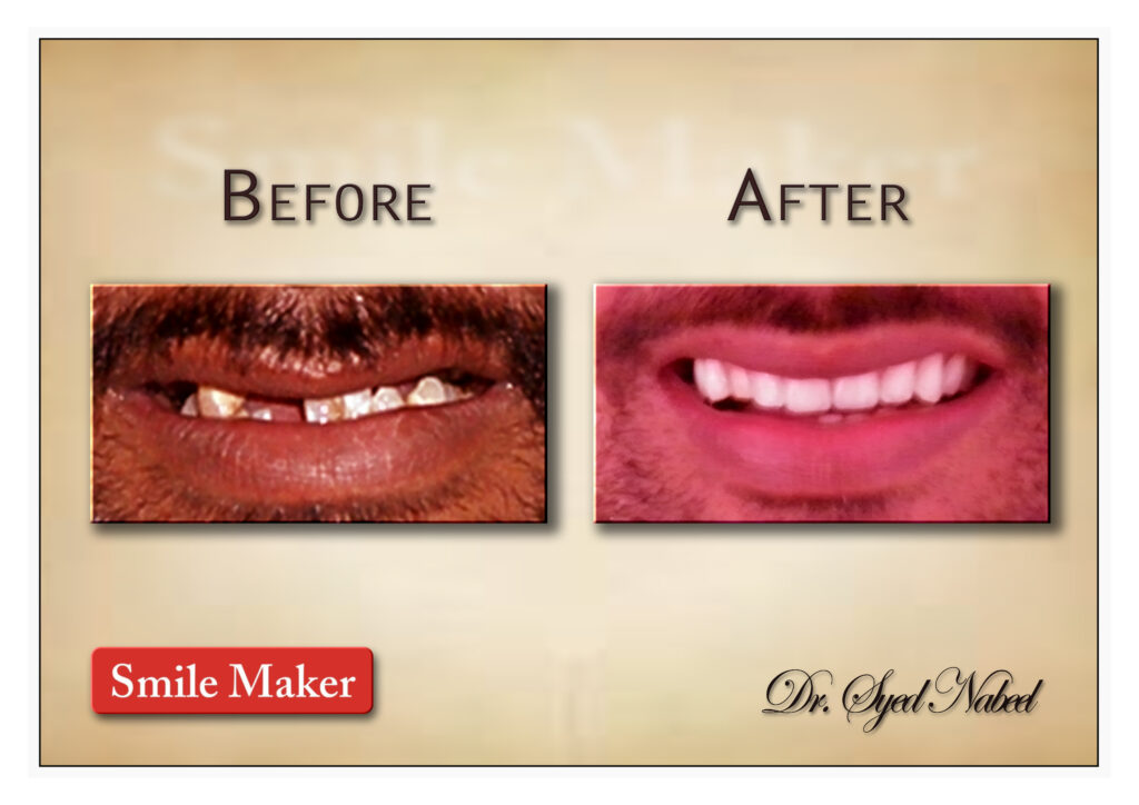 Alt="Smile Maker"