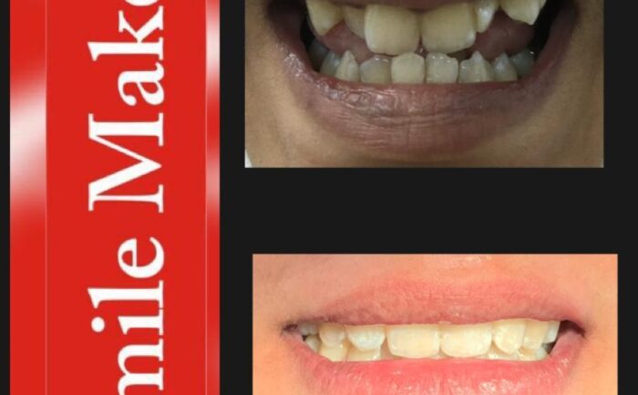 Alt="Smile Maker"