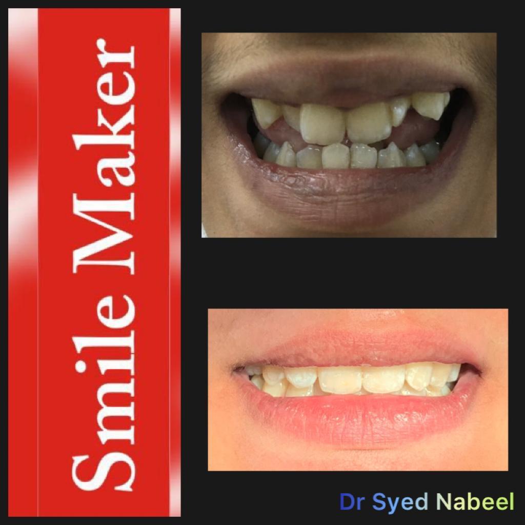 Alt="Smile Maker"