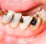 Alt = CAvity