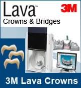 Alt="3m lava"